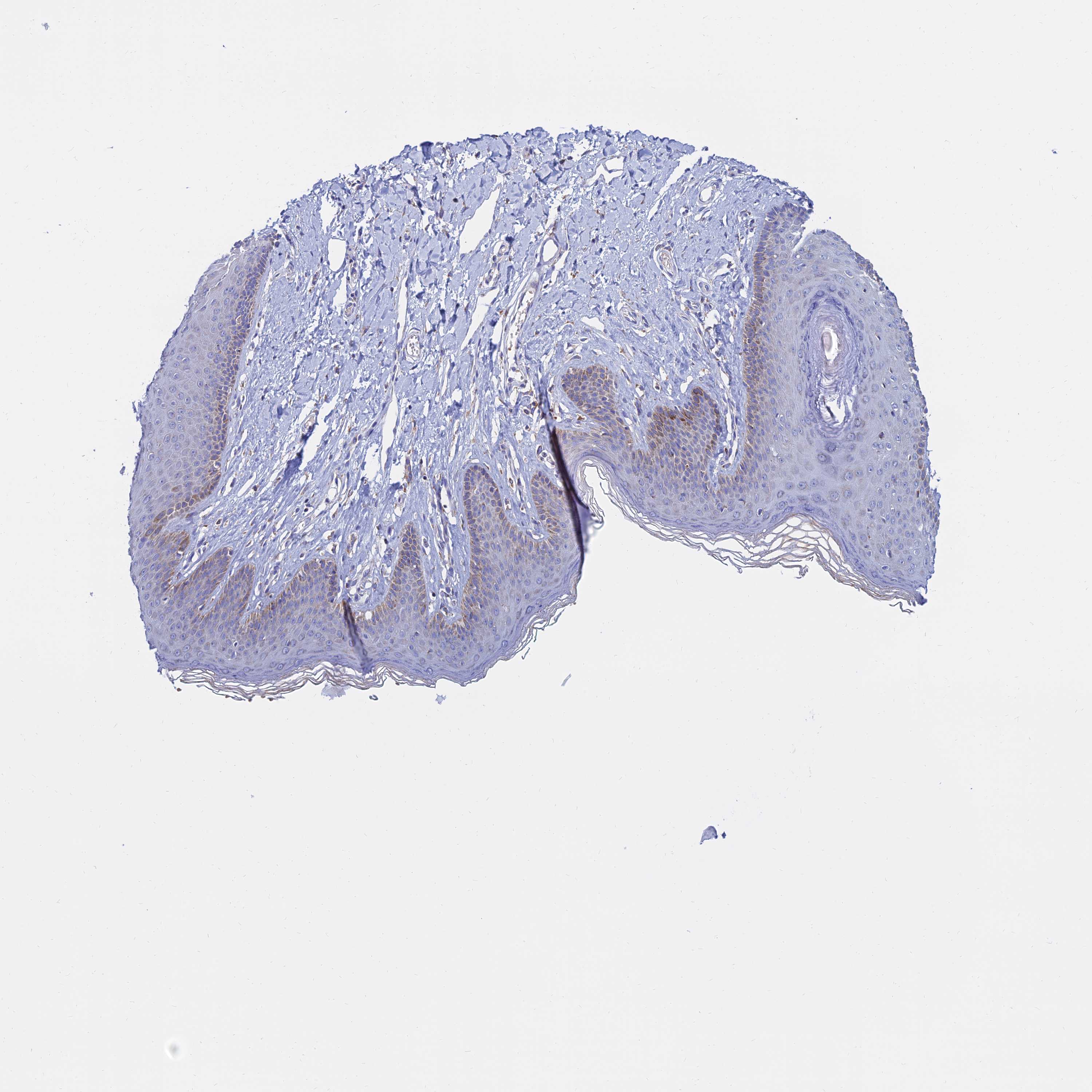 Tissue expression of MGST1 - Staining in skin - The Human Protein Atlas