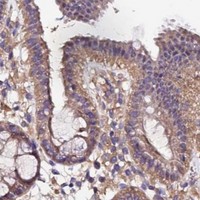 HPA IHC Colon — MTERF1