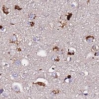 HPA IHC Cerebral cortex — MTERF1