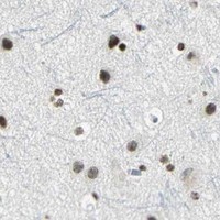HPA IHC Cerebral cortex — MCM4