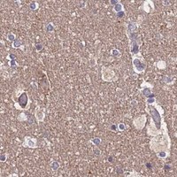 HPA IHC Cerebral cortex — UBE2N