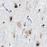 HPA IHC Cerebral cortex — MTA1