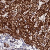 HPA IHC Liver — MPC1