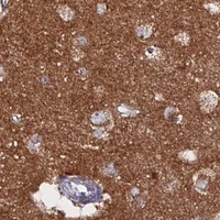 HPA IHC Cerebral cortex — MPC1