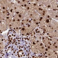 HPA IHC Liver — SIK3