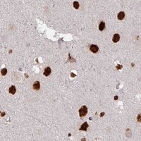 HPA IHC Cerebral cortex — SIK3