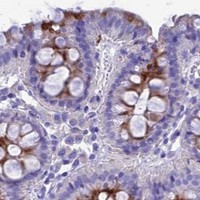 HPA IHC Colon — GNG11