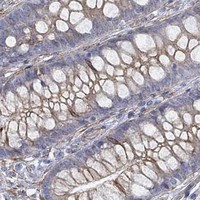 HPA IHC Colon — STC2