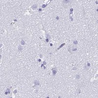 HPA IHC Cerebral cortex — ATP4B