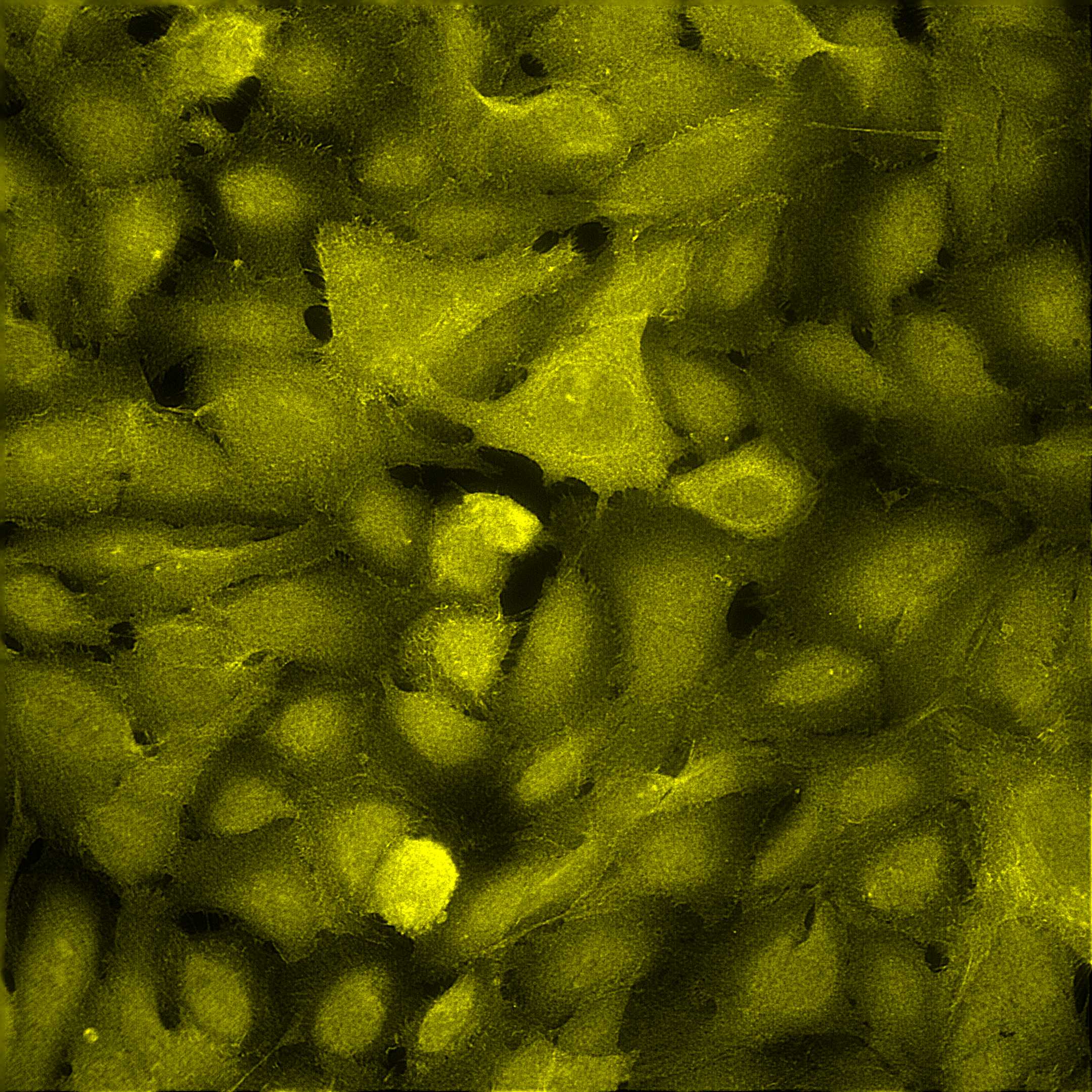 Subcellular CDK18 The Human Protein Atlas