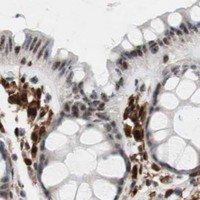 HPA IHC Colon — RGS10