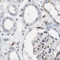 HPA IHC Kidney — RGS10