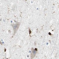 HPA IHC Cerebral cortex — RGS10