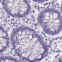 HPA IHC Colon — NOVA2