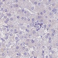 HPA IHC Liver — NOVA2