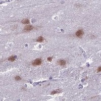 HPA IHC Cerebral cortex — NOVA2