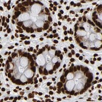 HPA IHC Colon — RXRA