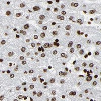 HPA IHC Liver — RXRA