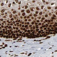 HPA IHC Esophagus — RXRA