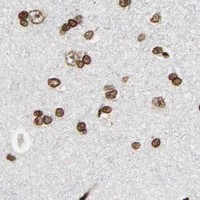 HPA IHC Cerebral cortex — RXRA