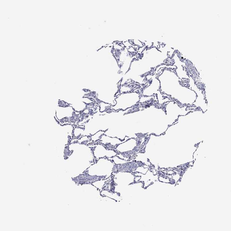 Tissue expression of SOX2 Staining in lung The Human Protein Atlas
