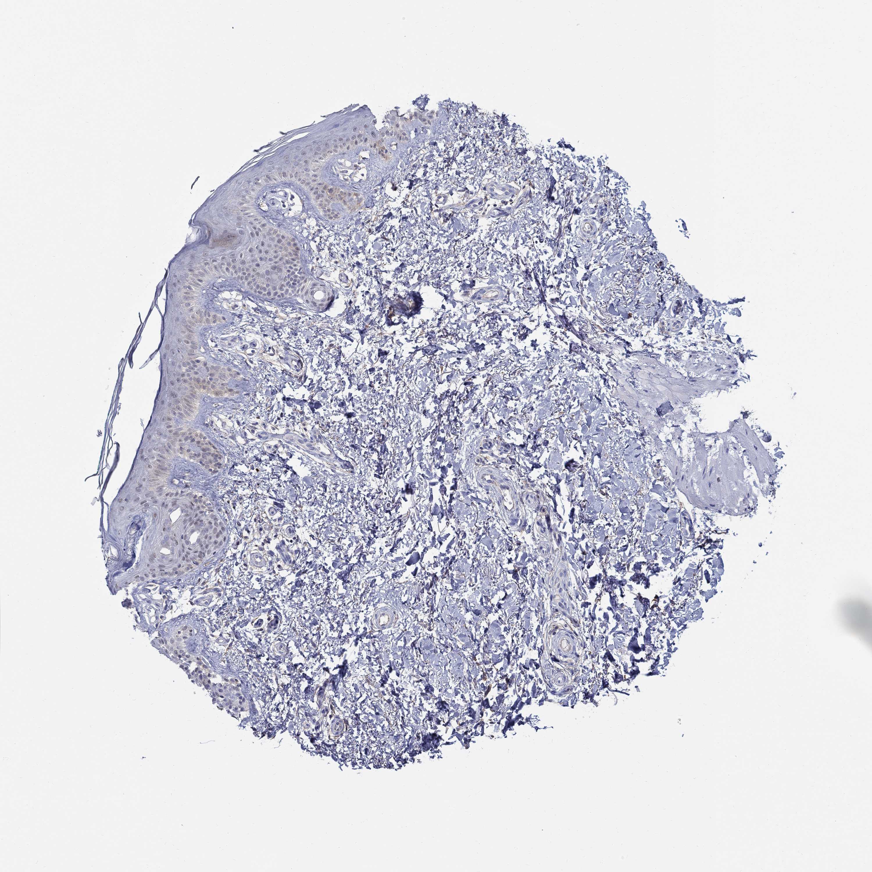 Tissue expression of SOX2 Staining in skin The Human Protein Atlas