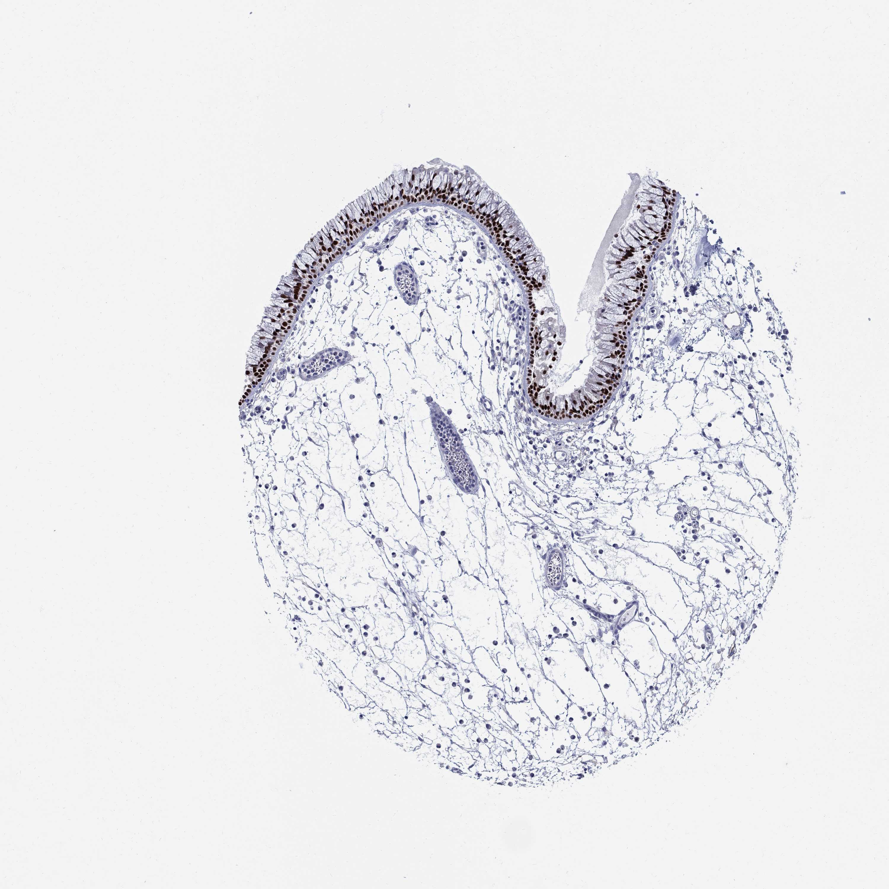 Tissue expression of SOX2 Staining in nasopharynx The Human Protein