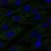 HPA045760: hTERT-RPE1 (serum starved)
