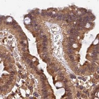 HPA IHC Colon — PDE4D