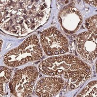 HPA IHC Kidney — PDE4D
