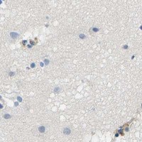 HPA IHC Cerebral cortex — THBS4