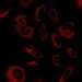 CAB004601: U-251 MG