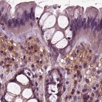 HPA IHC Colon — TUBG1