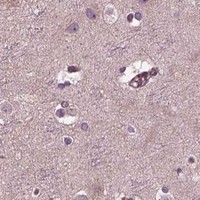 HPA IHC Cerebral cortex — TUBG1