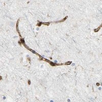 HPA IHC Cerebral cortex — VASP