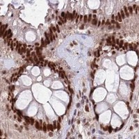 HPA IHC Colon — ZBTB7A