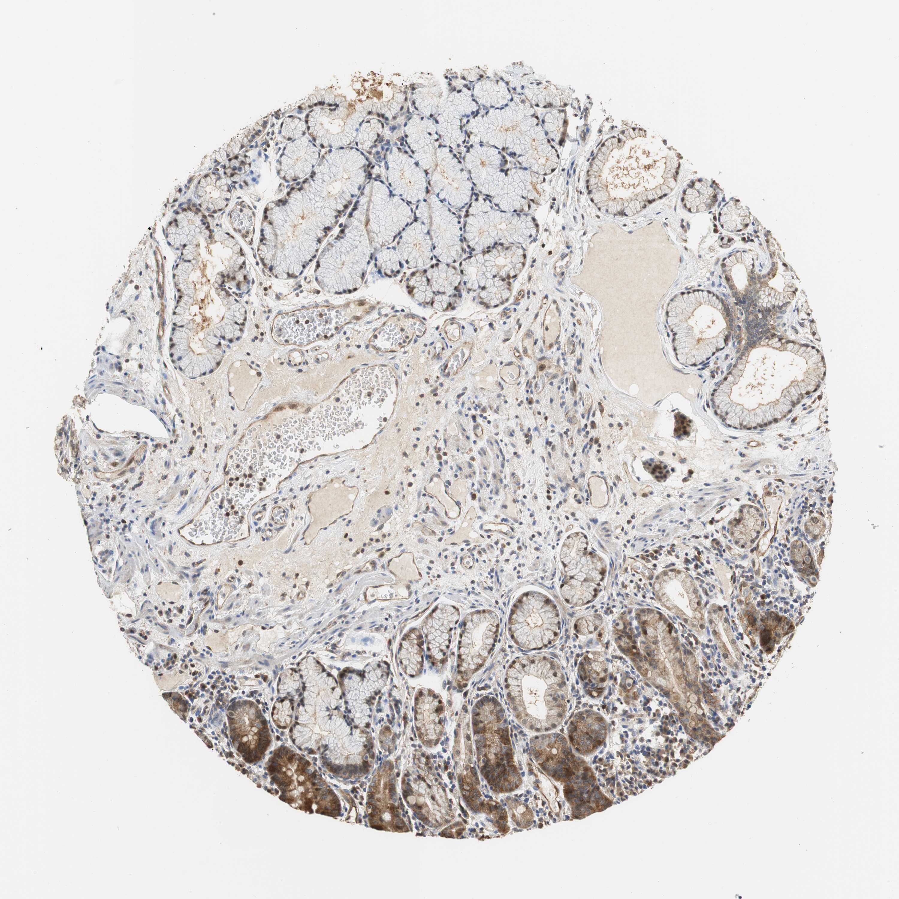 Tissue Expression Of Gsdmd Staining In Duodenum The Human Protein Atlas