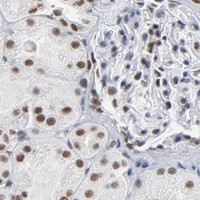 HPA IHC Kidney — CSTF2