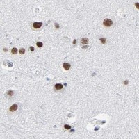 HPA IHC Cerebral cortex — CSTF2