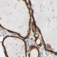 HPA IHC Thyroid gland — PRDX1