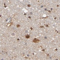 HPA IHC Cerebral cortex — PRDX1