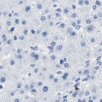 HPA IHC Liver — INHA