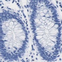 HPA IHC Colon — INHA