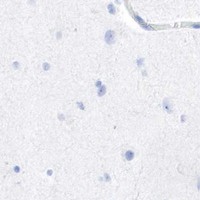 HPA IHC Cerebral cortex — INHA