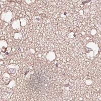 HPA IHC Cerebral cortex — TPM2
