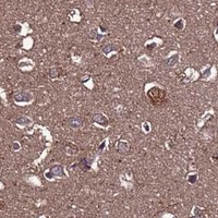 HPA IHC Cerebral cortex — RPS15A