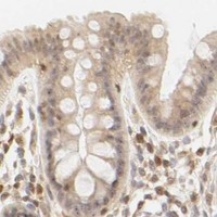 HPA IHC Colon — KIF2A
