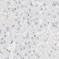 HPA IHC Liver — KIF2A