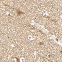 HPA IHC Cerebral cortex — KIF2A