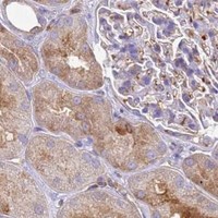 HPA IHC Kidney — HSPB1